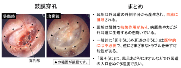 （図5）（図6）